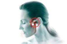 Bruxismo, ATM y disfunción mandibular en Fuenlabrada